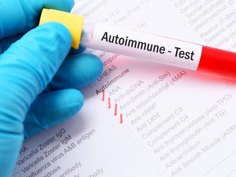 Understanding Autoimmunity Test Kits and Where to Buy?