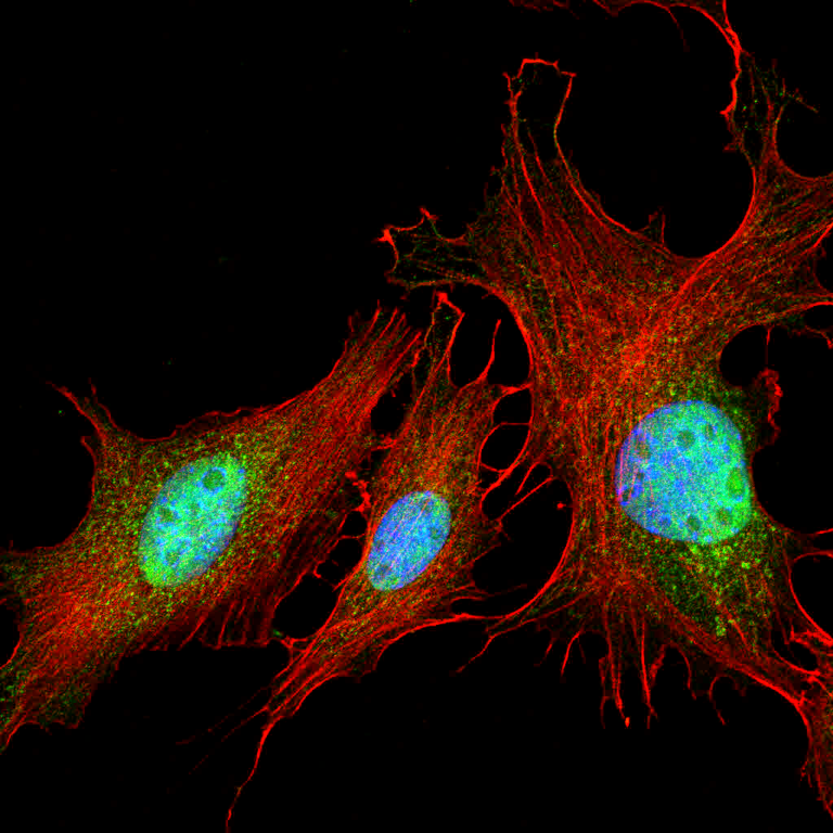 Understanding Immune Fluorescence Assay (IFA) Analyzers: A Revolutionary Tool in Diagnostics