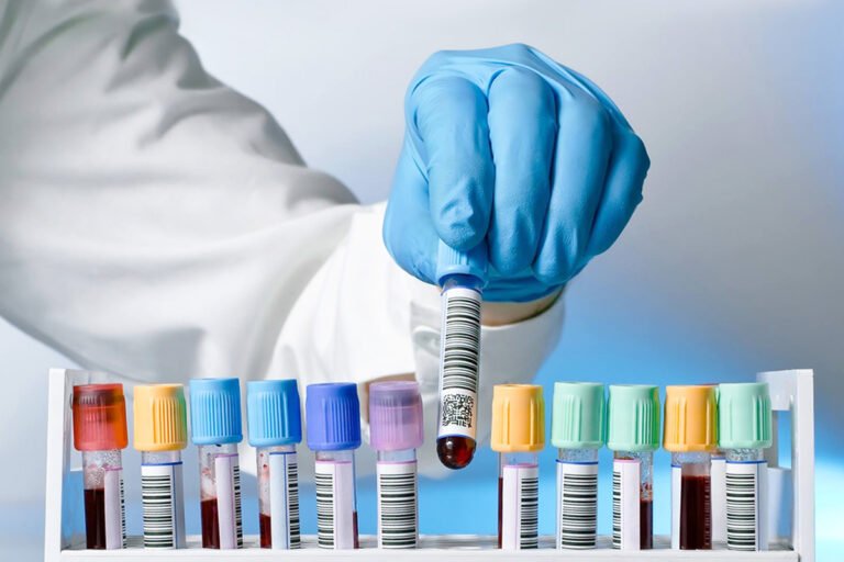 Understanding Blood Screening Tests: Importance, Types, and Diagnostic Solutions by Amindo Biologics