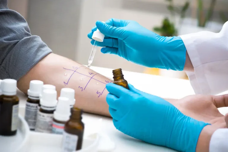Why We Recommend Line Immunoassay (LIA) Over Skin Prick Testing for Allergy Diagnosis