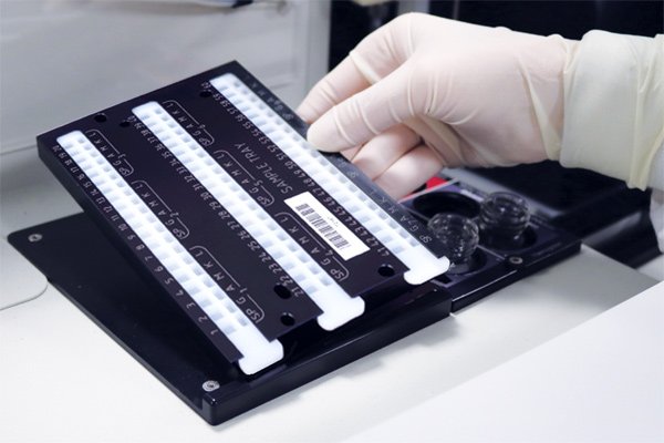 Gel Electrophoresis: A Powerful Technology Transforming Diagnostics