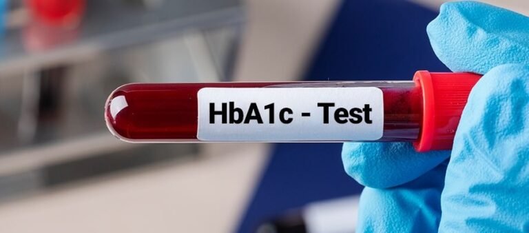 Clinical Significance of HbA1C and Its Diagnostic Importance